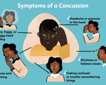 Symptoms of a Concussion What You Need to Know (2023)